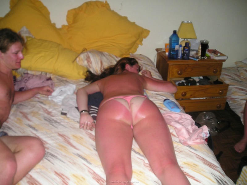 Пошлая краля обгорела на пляже 12 фотография