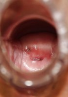 Зрелая медсестра в чулках мастурбирует вагину сидя в гинекологическом кресле 11 фотография